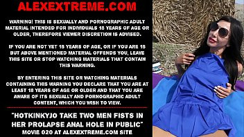Play Hotkinkyjo take two men fists in her prolapse anal hole in public